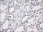 Fumarase Antibody in Immunohistochemistry (Paraffin) (IHC (P))