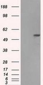 Fumarase Antibody in Western Blot (WB)