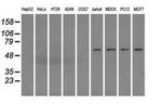 Fumarase Antibody in Western Blot (WB)