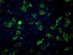 Fumarase Antibody in Immunocytochemistry (ICC/IF)