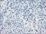 Fumarase Antibody in Immunohistochemistry (Paraffin) (IHC (P))