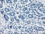 Fumarase Antibody in Immunohistochemistry (Paraffin) (IHC (P))