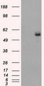 Fumarase Antibody in Western Blot (WB)