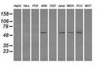 Fumarase Antibody in Western Blot (WB)