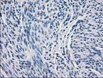 BCKDK Antibody in Immunohistochemistry (Paraffin) (IHC (P))
