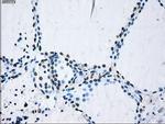 ID3 Antibody in Immunohistochemistry (Paraffin) (IHC (P))