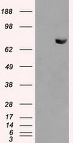 HDAC10 Antibody in Western Blot (WB)