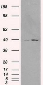 MAN1 Antibody in Western Blot (WB)
