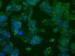 PFKFB4 Monoclonal Antibody (OTI1C8)