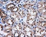 PPME1 Antibody in Immunohistochemistry (Paraffin) (IHC (P))