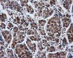 PPME1 Antibody in Immunohistochemistry (Paraffin) (IHC (P))