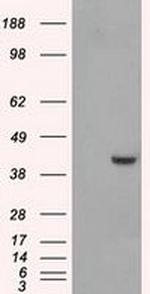 PPME1 Antibody in Western Blot (WB)