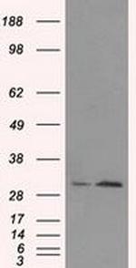 TIPRL Monoclonal Antibody (OTI3D11)