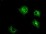 LOX Monoclonal Antibody (OTI9G6)
