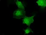 Transketolase Monoclonal Antibody (OTI5H3)