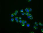 IFIT1 Antibody in Immunocytochemistry (ICC/IF)