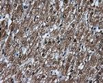 KIAA1609 Antibody in Immunohistochemistry (Paraffin) (IHC (P))