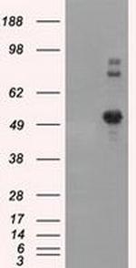 SIL1 Antibody in Western Blot (WB)