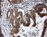 KIAA1609 Antibody in Immunohistochemistry (Paraffin) (IHC (P))