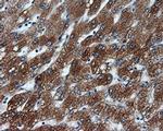 KIAA1609 Antibody in Immunohistochemistry (Paraffin) (IHC (P))