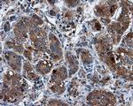 KIAA1609 Antibody in Immunohistochemistry (Paraffin) (IHC (P))