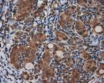 KIAA1609 Antibody in Immunohistochemistry (Paraffin) (IHC (P))