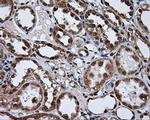 TUBA8 Antibody in Immunohistochemistry (Paraffin) (IHC (P))