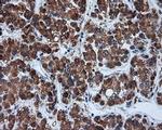 TUBA8 Antibody in Immunohistochemistry (Paraffin) (IHC (P))