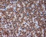 TUBA8 Antibody in Immunohistochemistry (Paraffin) (IHC (P))