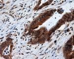 RF1ML Antibody in Immunohistochemistry (Paraffin) (IHC (P))