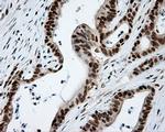 KIAA1609 Antibody in Immunohistochemistry (Paraffin) (IHC (P))