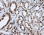 KIAA1609 Antibody in Immunohistochemistry (Paraffin) (IHC (P))