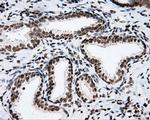SHC Antibody in Immunohistochemistry (Paraffin) (IHC (P))