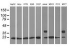 RhoGDI Antibody in Western Blot (WB)