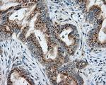 NIT2 Antibody in Immunohistochemistry (Paraffin) (IHC (P))