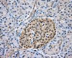 CAPZA1 Antibody in Immunohistochemistry (Paraffin) (IHC (P))