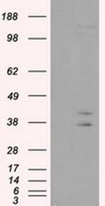 CAPZA1 Antibody in Western Blot (WB)