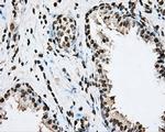 BMAL1 Antibody in Immunohistochemistry (Paraffin) (IHC (P))