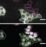 Profilin 1 Monoclonal Antibody (OTI1D5)