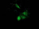 ACAT2 Monoclonal Antibody (OTI7B1)