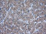 ACAT2 Antibody in Immunohistochemistry (Paraffin) (IHC (P))