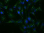 H6PD Monoclonal Antibody (OTI1H6)
