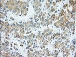 H6PD Antibody in Immunohistochemistry (Paraffin) (IHC (P))