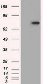 H6PD Antibody in Western Blot (WB)