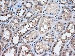 Profilin 1 Antibody in Immunohistochemistry (Paraffin) (IHC (P))