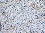 Profilin 1 Antibody in Immunohistochemistry (Paraffin) (IHC (P))