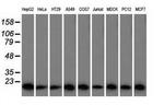 Profilin 1 Antibody in Western Blot (WB)