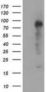 TACC3 Antibody in Western Blot (WB)