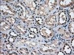 TACC3 Antibody in Immunohistochemistry (Paraffin) (IHC (P))