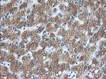 TACC3 Antibody in Immunohistochemistry (Paraffin) (IHC (P))